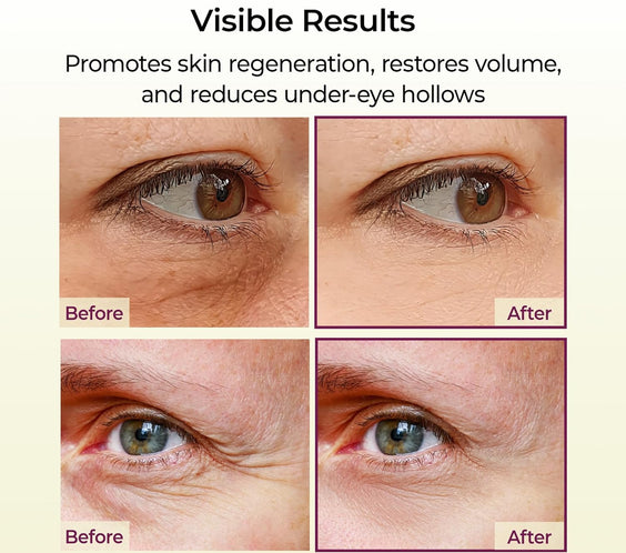 Cemenrete Calcium Multi Balm 9g