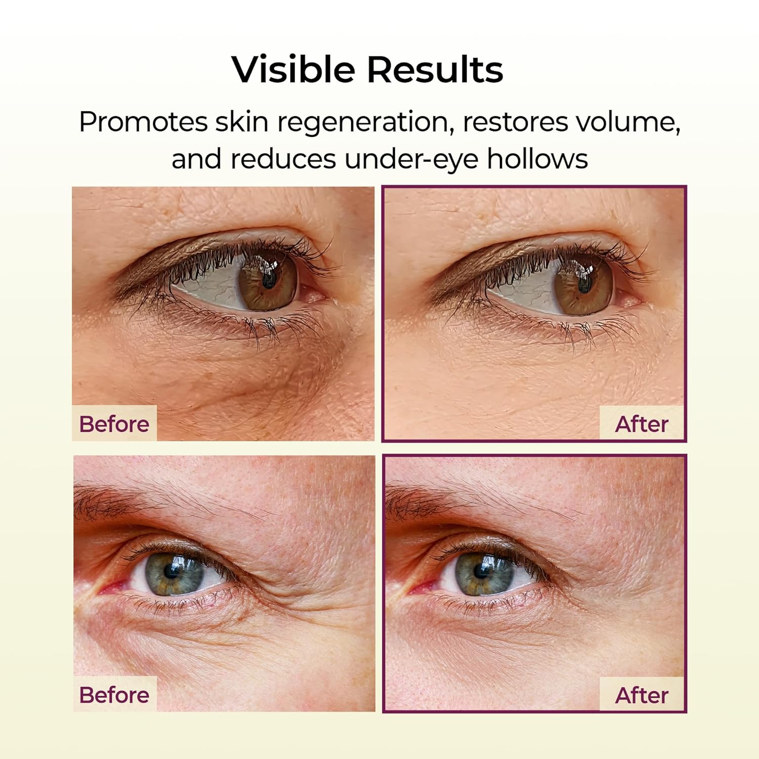 Cemenrete Calcium Multi Balm 9g